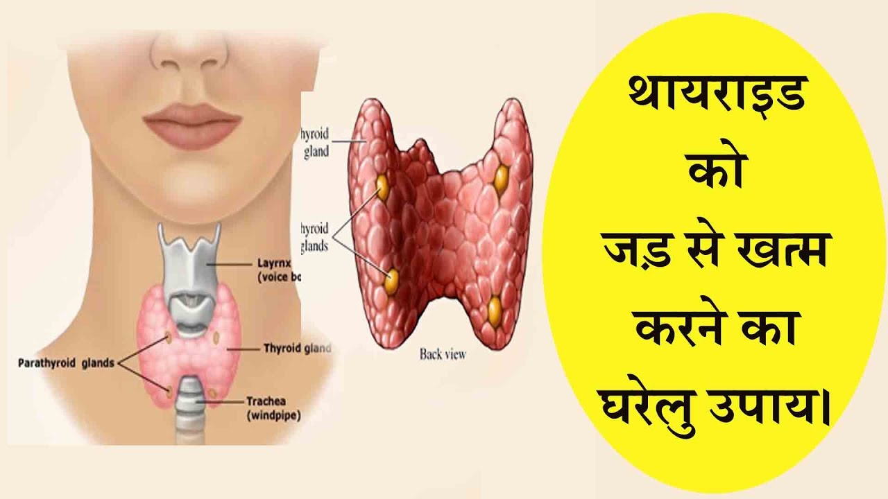 Thyroid in Hindi थायरॉइड के घरेलू उपाय
